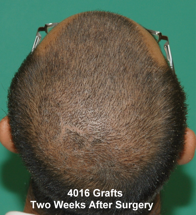 4016twowkpostop.jpg man