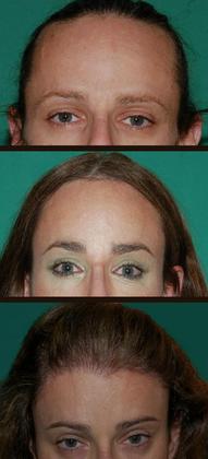 Stages of treatment, from front